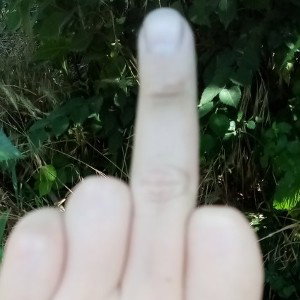 перепонки отсасонки