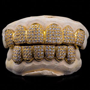 Diamonds