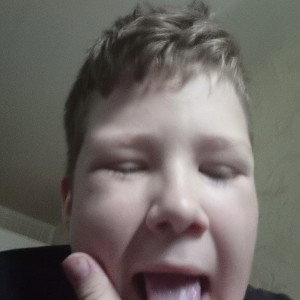 Toxin_-_Benedixhion