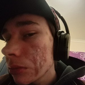 Skin Condition
