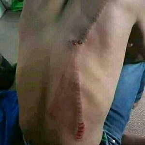 bad luck