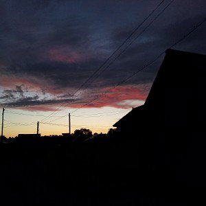 шум в ушах