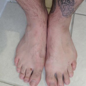 smelly feet