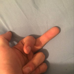 Die 