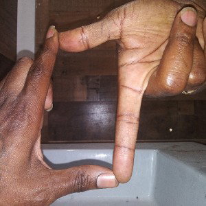 L7BARRS
