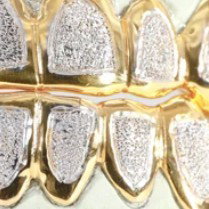 Gold Mine