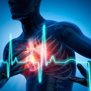 Crise cardiaque et Coup de cœur