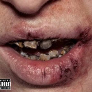 Black teeth 