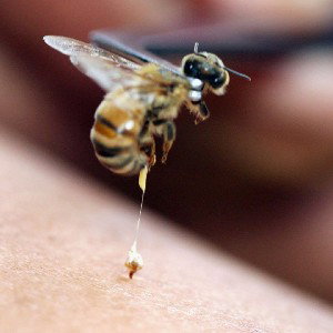 Sting Like A Bee