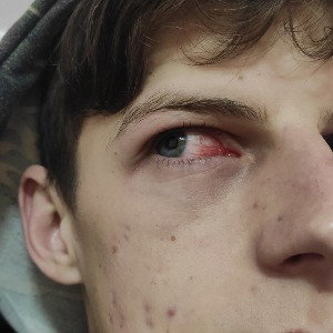 ХантерВампир