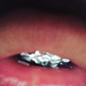  Grill