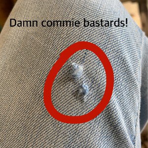 #GrannyAreola