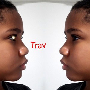 Late Trav