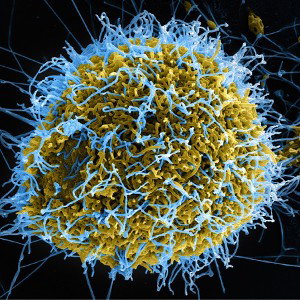 virus 