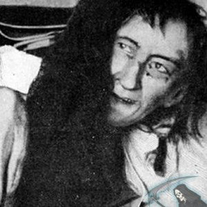 Безумие