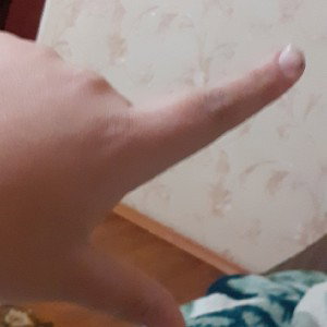 БАТЛ