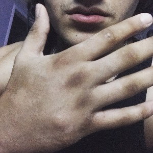 Damage (17:17)