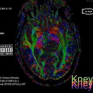 Encefa   - Kney prod