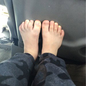 Black toes