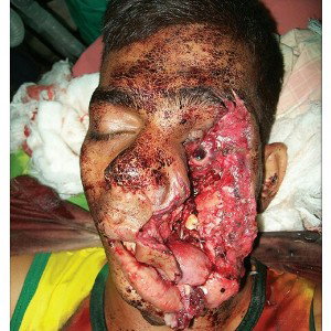 Meat Off Yo Face 