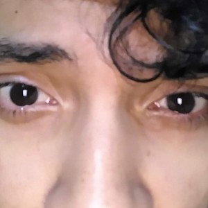 Pain