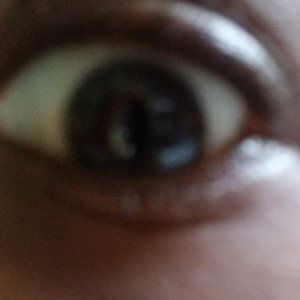 my face is dark 