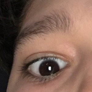 Hyper