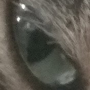 OBS EY EYE