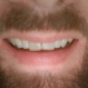 get yo teeth right