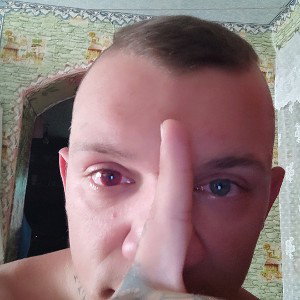 б
