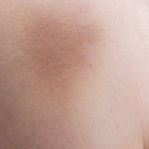 abused
