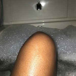 So cold right