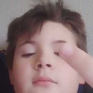 Bkhll