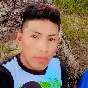 Gonorrea