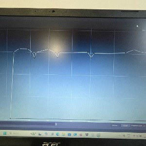 Galvanic elementz 