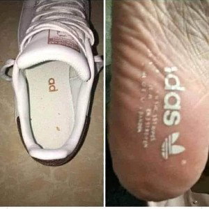  los adidas