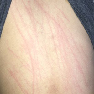 Abusive relationship