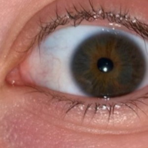 mach kein auge 2