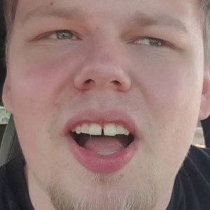 kommplet cringe mit Galaxydrp😂😂😂