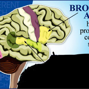 Broca’s Freestyle 
