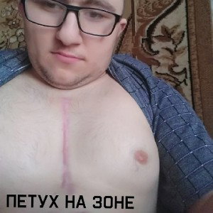 DISS (PRO$TO1) ОЧКОПОИНТ