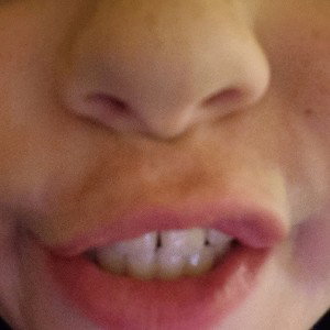 crazynogens
