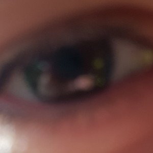 mach kein auge