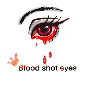 blood shot eyes