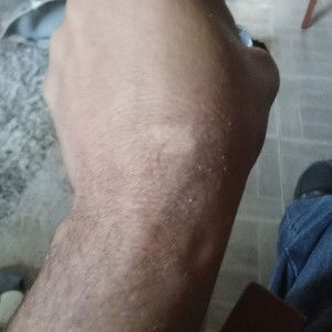 big_spot_2_
