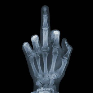 X-Ray  