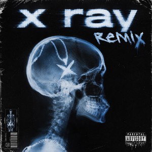 X-ray (REMIX)