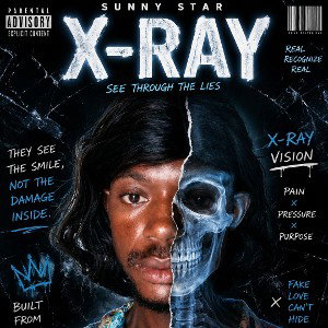 X-ray 🩻