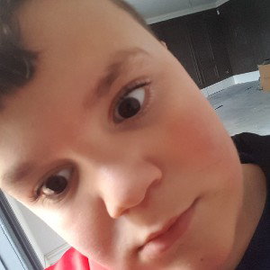100