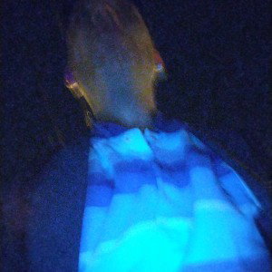Suspect on my back/Is it cause im black!!!